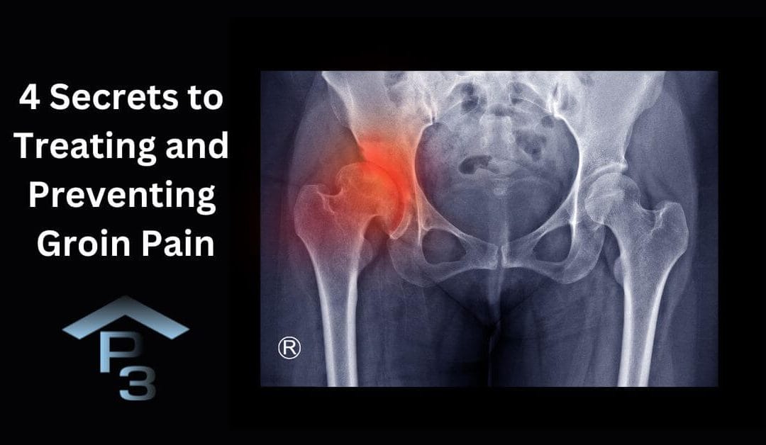 4 Secrets To Treating and Preventing A Groin Strain