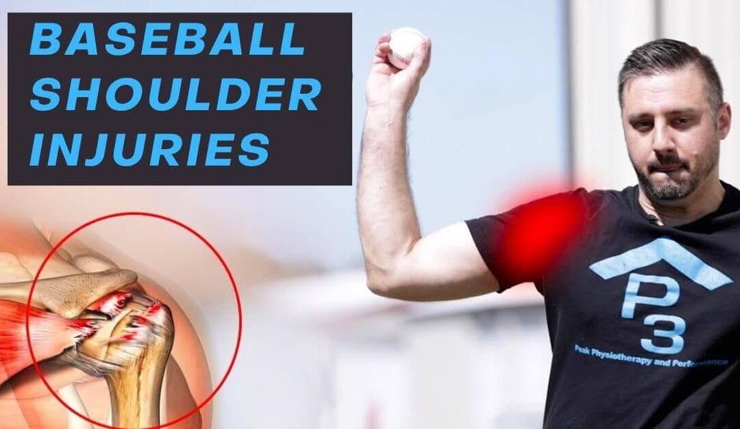 Baseball Shoulder Injuries | 3 Leading Causes of Shoulder Pain